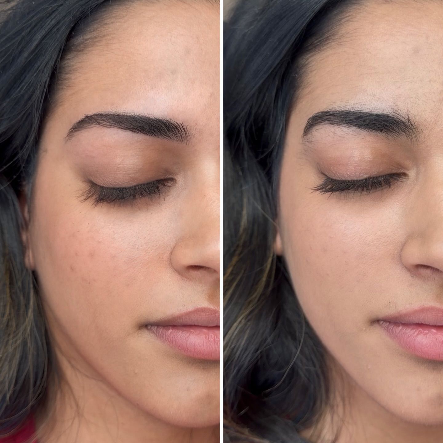 Brow threading before and after